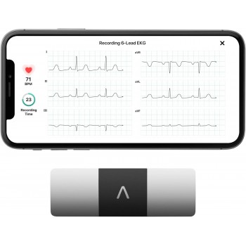 Портативний электрокардіограф AliveCor KardiaMobile 6L AC-019-NUA-A (P-202540) Портативний электрокардіограф AliveCor KardiaMobile 6L AC-019-NUA-A (P-202540)