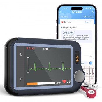 Портативний электрокардіограф Viatom Checkme Plus (P-202541) Портативний электрокардіограф Viatom Checkme Plus (P-202541)